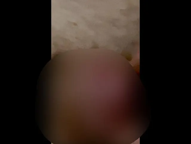 Um durfte er spritzen