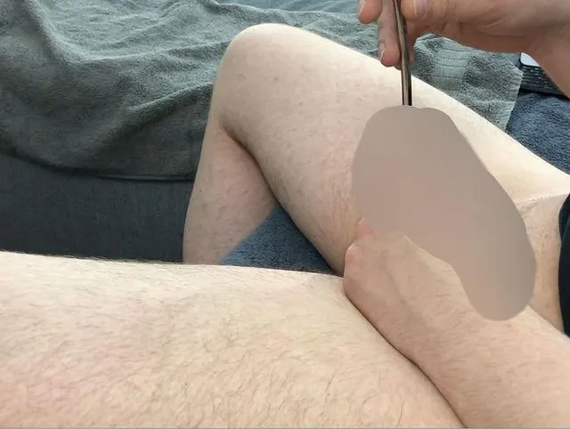 Video 077 - Erstes gemeinsames Dilatoren Video Cam 2 Teil1-5