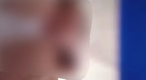 Etwas andere Perspektive von SB und Gummi und Einlage