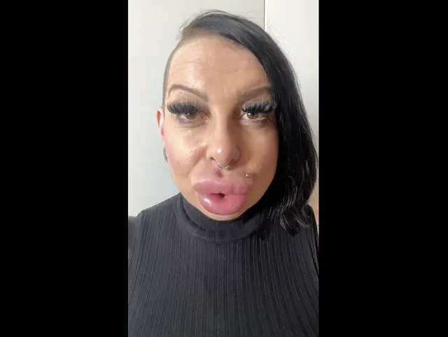 Talking about my plump lips