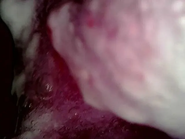 Medical Endoscope Oral Exam: Gummy Chewing, Extreme Teeth & Tongue Macro