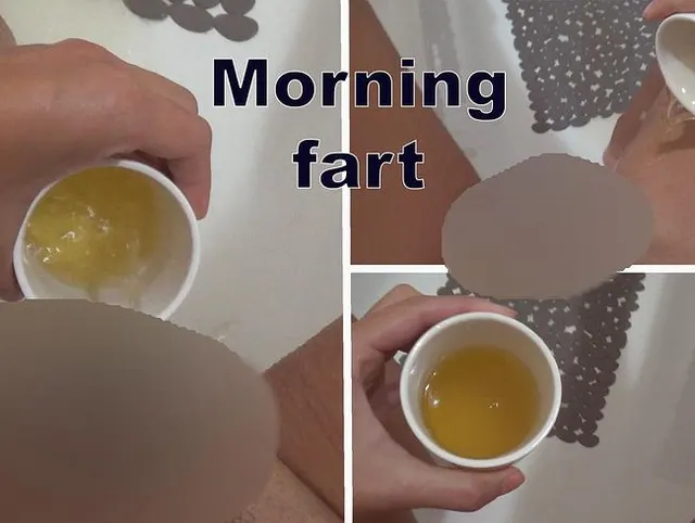 Tasse Urin.
