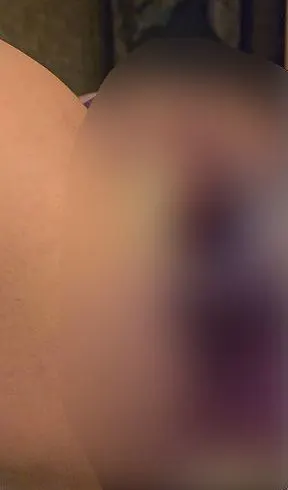 Harnröhre fick der 1.