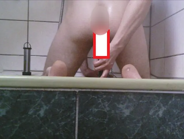anal Dehnung